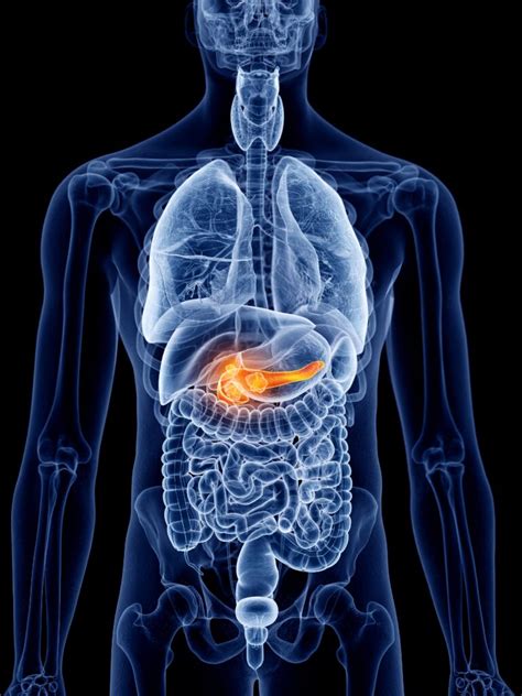 Understanding Acute Pancreatitis Causes Symptoms And Treatment Ask